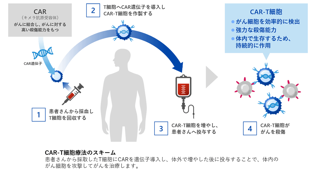 CAR-T細胞療法
