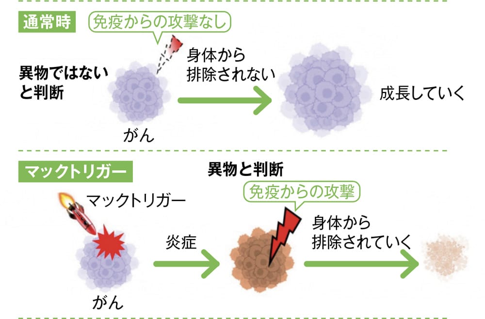 マックトリガーの仕組み