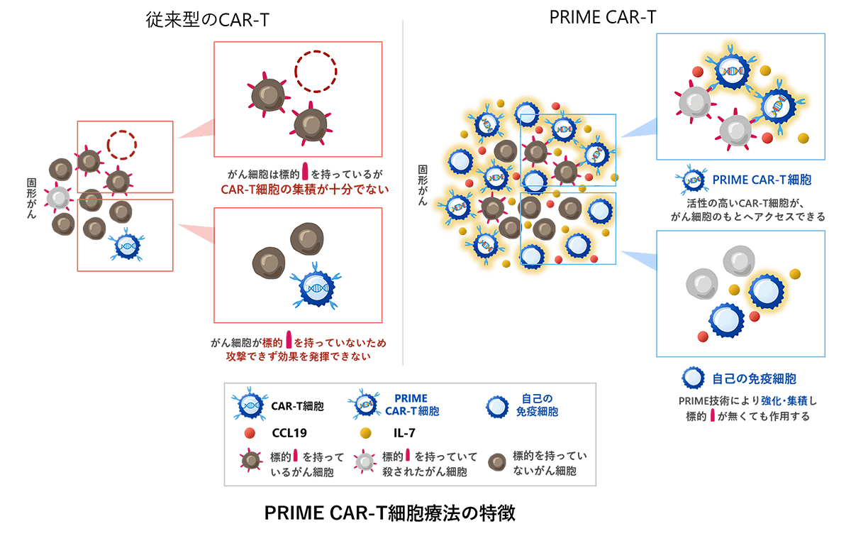 PRIME CAR-T療法
