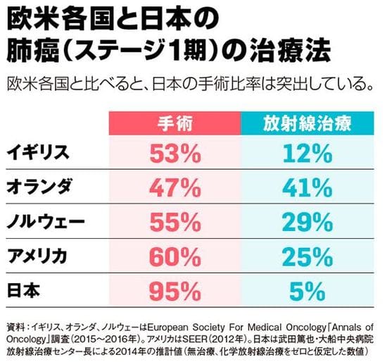 欧米各国と日本の肺がん（ステージ1期）の治療法